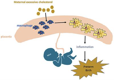 Maternal Hypercholesterolemia May Involve in Preterm Birth